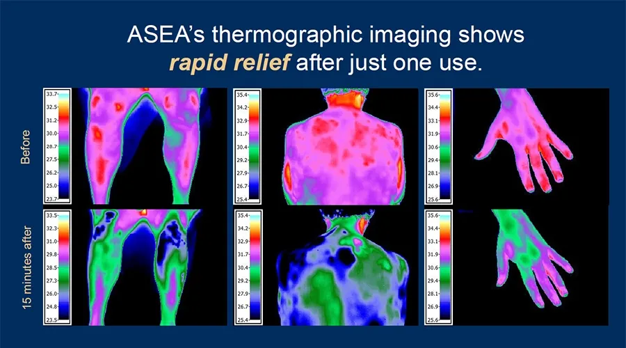 ASEA's thermographic imaging shows rapid relief after just one use